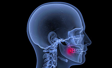 Treatment - Bristol Dental Suite